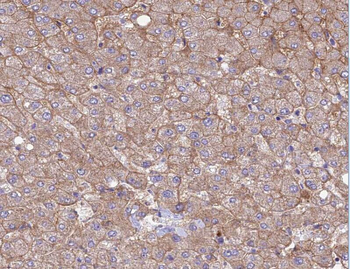 ABLIM1 Antibody