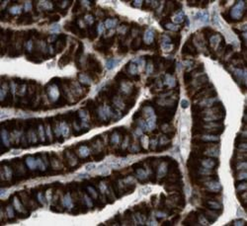 ACAA1 Antibody