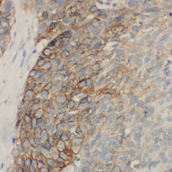 ACAA2 Antibody