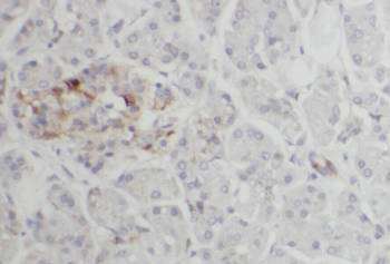 ACAD10 Antibody