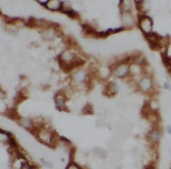 ACADM Antibody