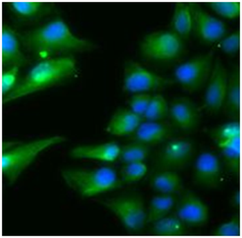 ACADS Antibody