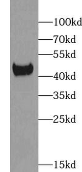 ACADS Antibody