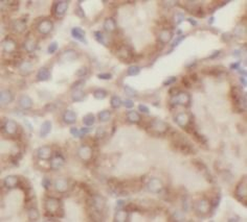 ACADS Antibody