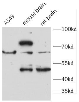ACADVL Antibody