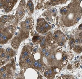 ACADVL Antibody