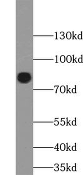 ACAP1 Antibody
