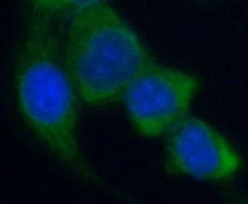 ACACA Rabbit Polyclonal Antibody