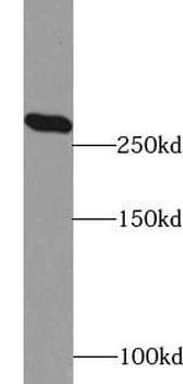 ACACA Antibody