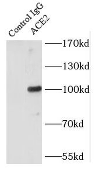 ACE2 Antibody