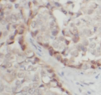 TNK2 Antibody