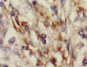 ACO2 Antibody