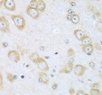ACOX1 Antibody