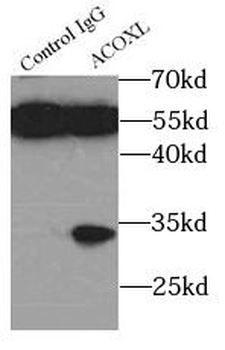ACOXL Rabbit Polyclonal Antibody