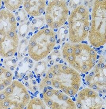 ACP1 Antibody