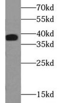 ACP5 Antibody