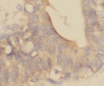 ACP5 Antibody