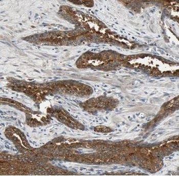 ACP6 Antibody