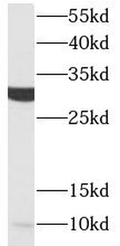 ACRV1 Antibody