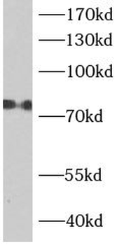 ACSL1 Antibody