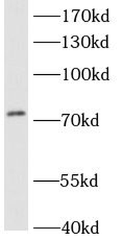 ACSL3 Rabbit Polyclonal Antibody