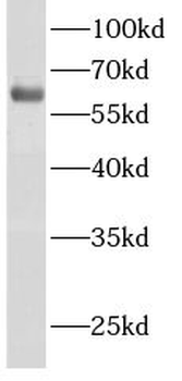 ACSM2A Rabbit Polyclonal Antibody