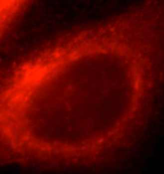 ACSM3 Antibody