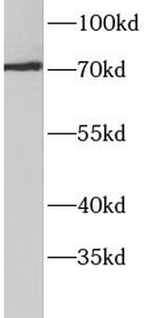 ACSS3 Antibody