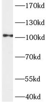 ACTN4 Antibody