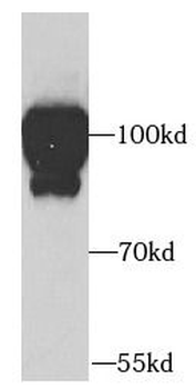 ADAM12 Antibody