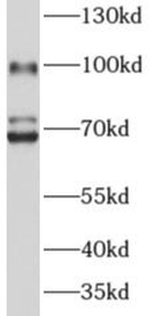 ADAM2 Rabbit Polyclonal Antibody