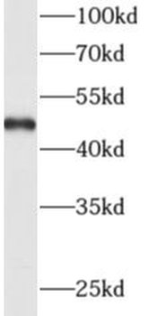ADAM5 Rabbit Polyclonal Antibody