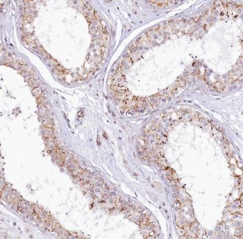 ADAM5 Rabbit Polyclonal Antibody
