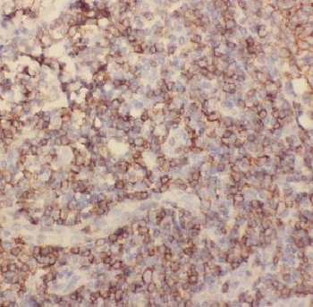 ADAM8 Antibody