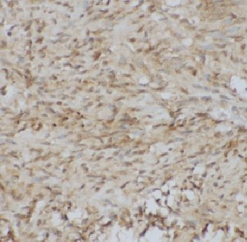 ADAMTS12 Antibody
