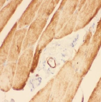 ADAMTSL4 Antibody