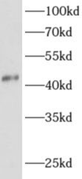 ADAP1 Antibody