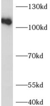 ADAR Antibody