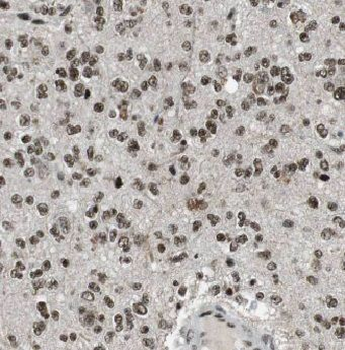 ADAR Antibody
