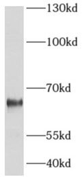 ADCK5 Antibody