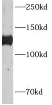 ADCY6 Antibody