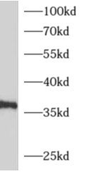 ADORA1 Antibody