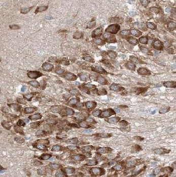 ADORA1 Antibody