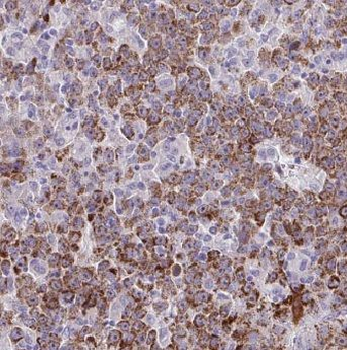 ADSL Antibody