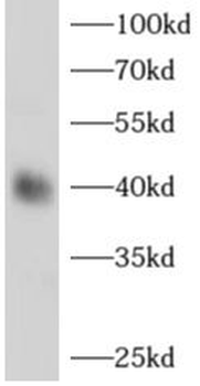 ADH1B Antibody