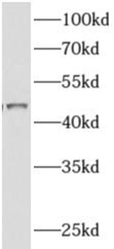 ADHFE1 Antibody