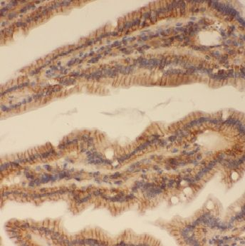 ADHFE1 Antibody