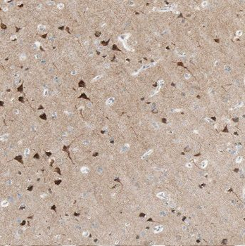 ADO Antibody