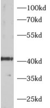ADRM1 Antibody