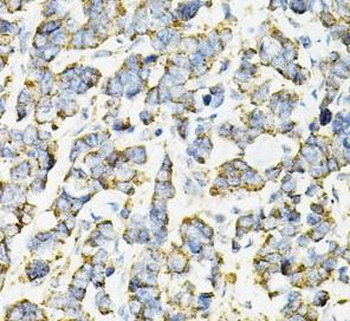 ADSS2 Antibody